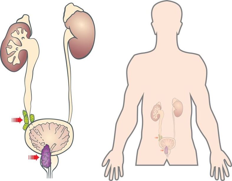 prostatos adenomos simptomai ir priežastys