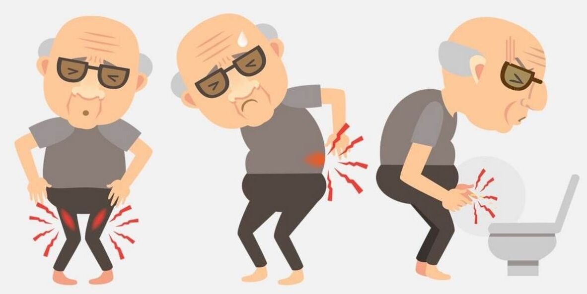 prostatito simptomai